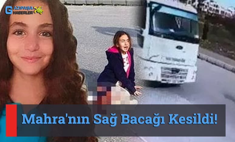 Mahra'nın Sağ Bacağı Kesildi!